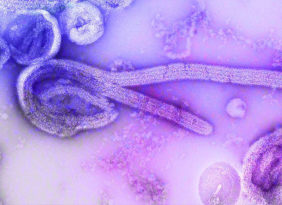 This is an electron microscopic image of the 1976 isolate of Ebola virus. The internal structures of the filamentous particle are visible, including the nucleocapsid and other structural viral proteins, and the outer viral envelope is covered with surface projections. The characteristic “6-shape” of the virus is evident.